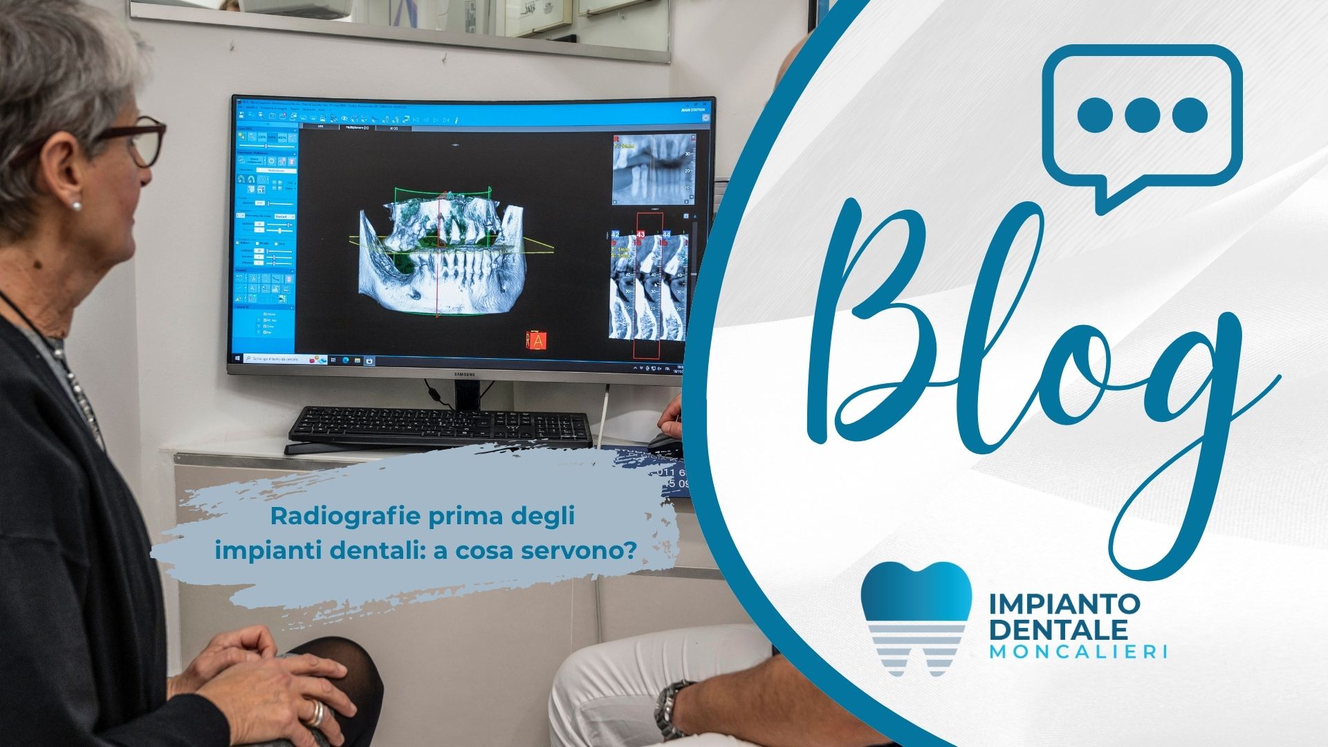 panoramica tac radiografie